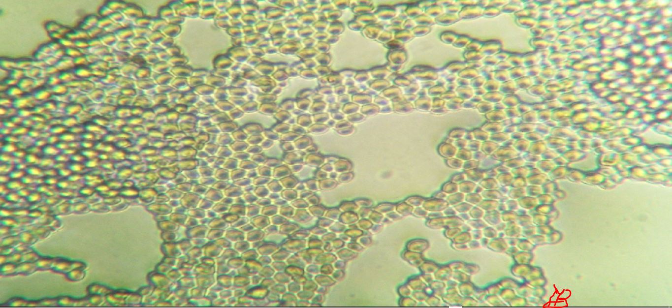 saccaromycaes cerevisiae (? )